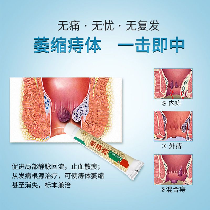 【痔疮膏消肉球】痔疮膏内外痔混合痔治痔疮软膏便秘胀痛止血止痛