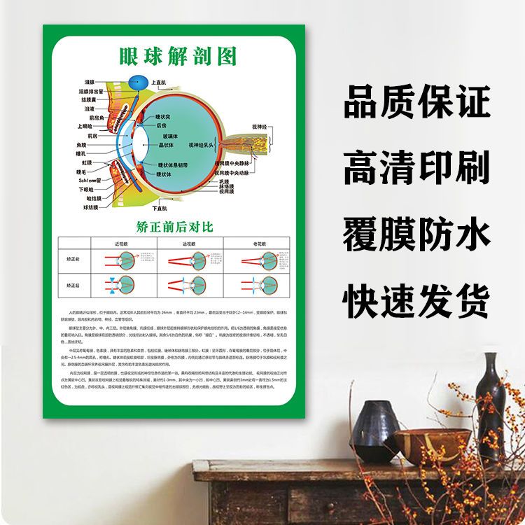 眼睛结构图眼球解剖图剖面图眼镜店矫正挂图眼科海报墙贴宣传图