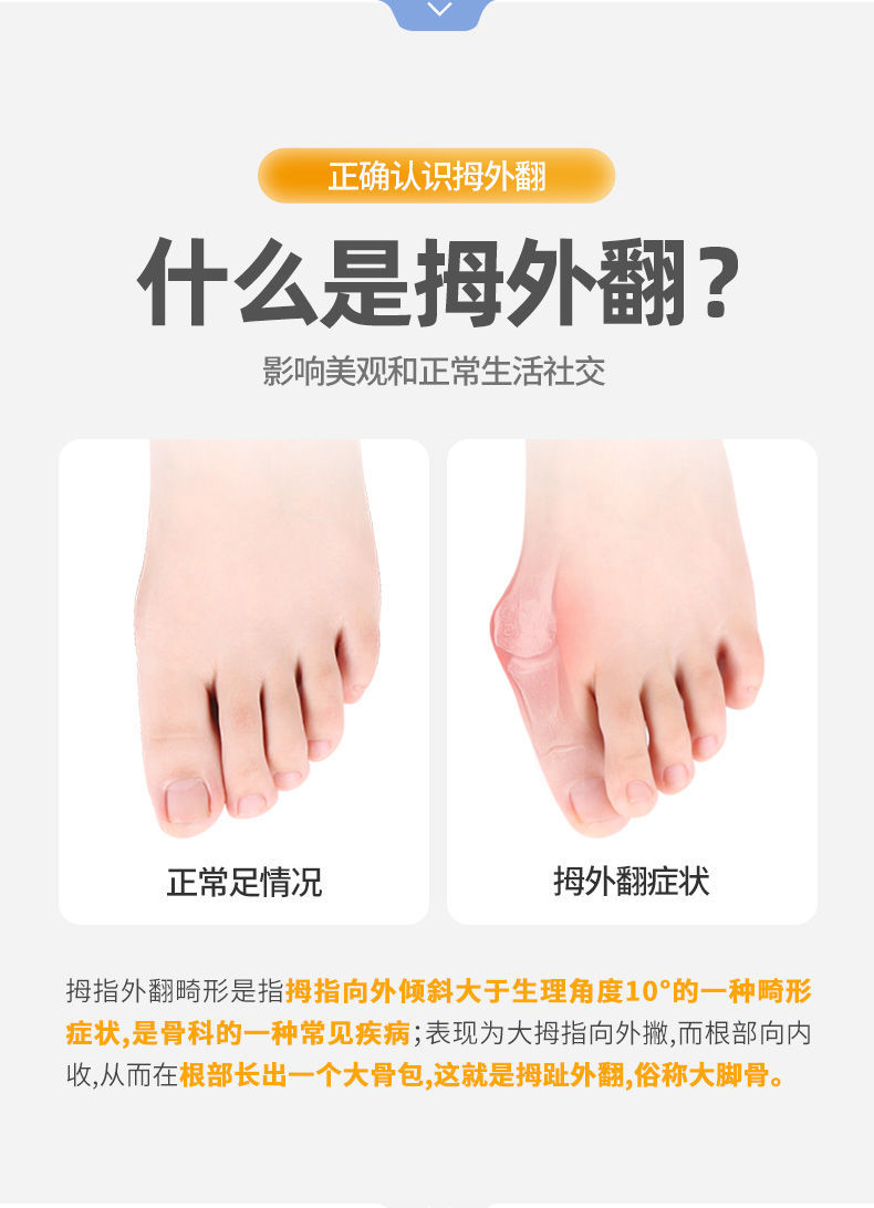 拇外翻矫正器脚趾外翻大拇指外翻内翻大脚骨足外翻脚趾重叠矫正器