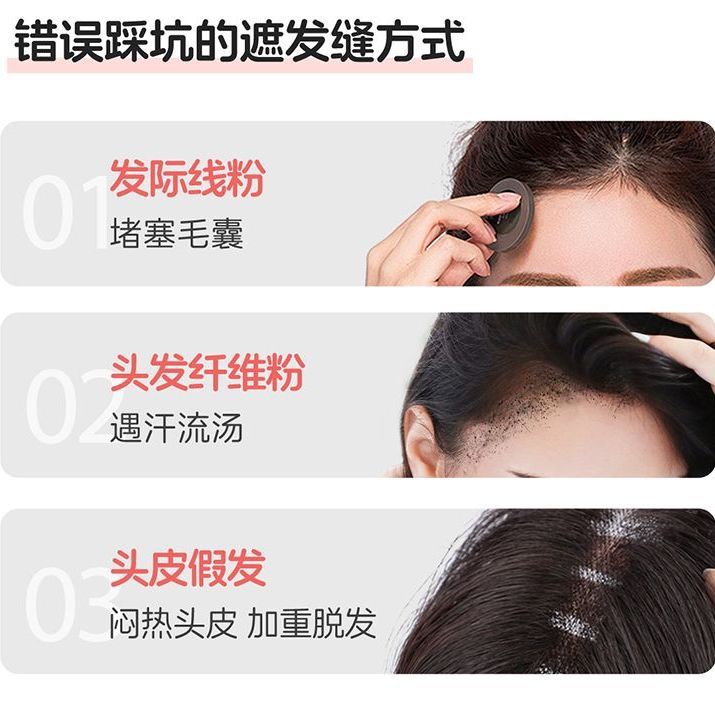 蔓迪 米诺地尔酊 30ml*3瓶/盒 男女士防脱生发喷雾斑秃育发液曼迪5%浓度米诺生发喷雾产后斑秃 图片 4