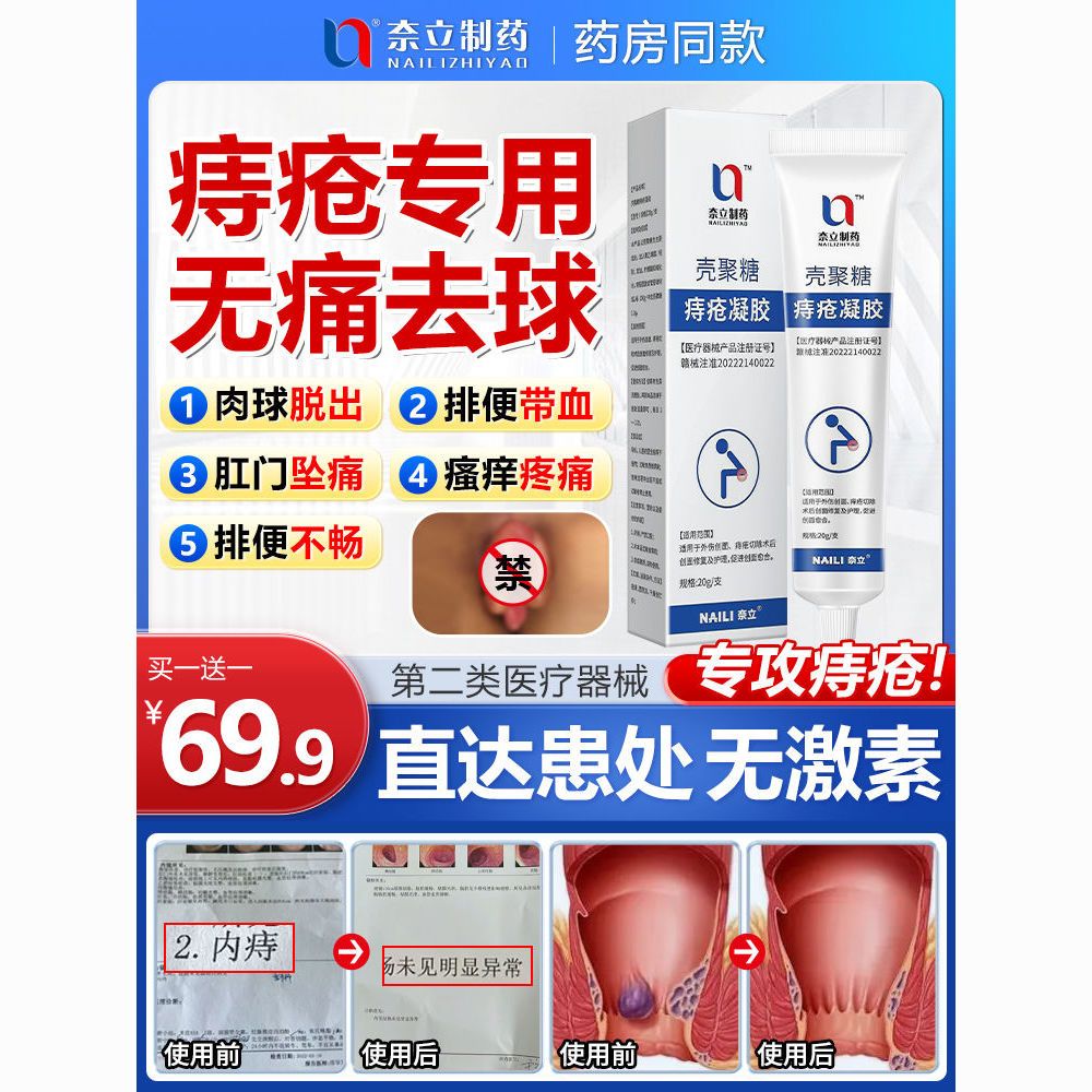 奈立壳聚糖痔疮膏消肉球断内外痔根医用级凝胶痔疮专用正品官方20