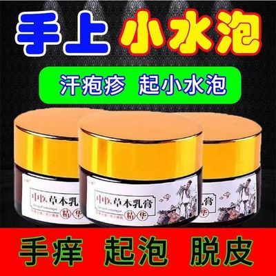 湿疹止痒膏皮肤瘙痒干燥脱皮性皮炎手足癣湿痒抑菌止痒膏