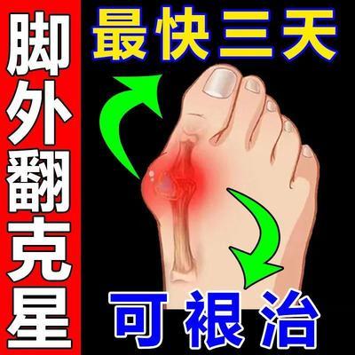 72806/【101%全愈】拇指外翻矫正器大脚拇指外翻脚趾重叠疼痛专用走珠器