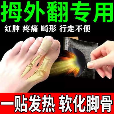 72801/【当晚矫正】大拇指外翻矫正器脚趾矫正器大脚趾矫正防磨防痛神贴