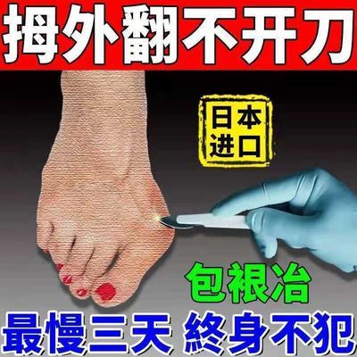 75618/成功率99%】拇外翻神器男女士大脚骨足外翻矫正器脚趾重贴专用贴