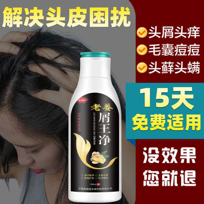 91225/去屑止痒护发除螨控油老姜精华滋养发囊防脱固发柔顺无硅油洗发水