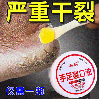 91995/手足裂口油开皲裂膏裂可宁护手霜保湿滋润脚后跟干裂干燥开裂脱皮