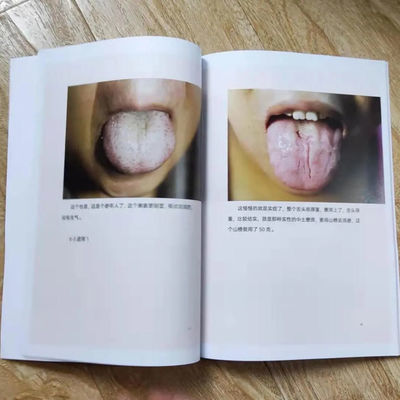 中医舌苔内部交流资料 辨舌开方中药处方舌苔彩色图解