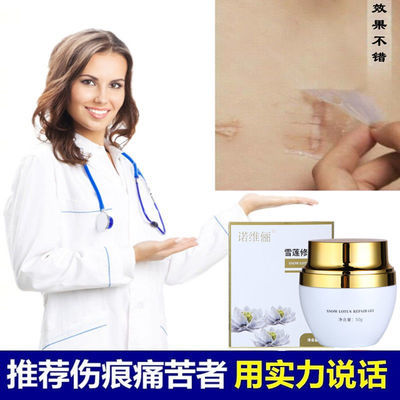 105589/诺维俪手术伤口凹凸无痕去老疤刀疤摔伤烫伤增生膏修复色素痘坑印