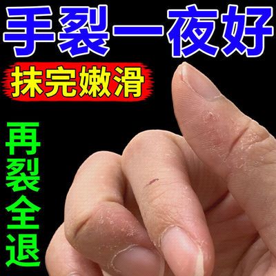 手裂愈合膏干裂裂口手脱皮干燥开裂真菌感染止痒膏手足干裂皲裂膏