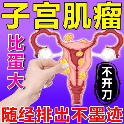子宫肌瘤卵巢囊肿下腹坠胀疼痛宫颈纳囊宫寒痛经小腹下坠中药贴
