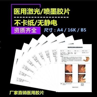 医用胶片瓷白喷墨打印胶片胃镜肠镜B超四维彩超B超打印纸b超单子