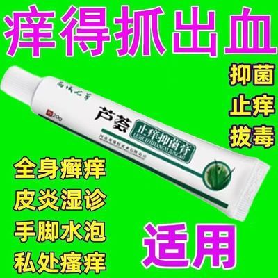 芦荟止痒抑菌膏皮炎湿疹皮肤瘙痒抑菌止痒外用特效蚊虫叮咬荨麻疹