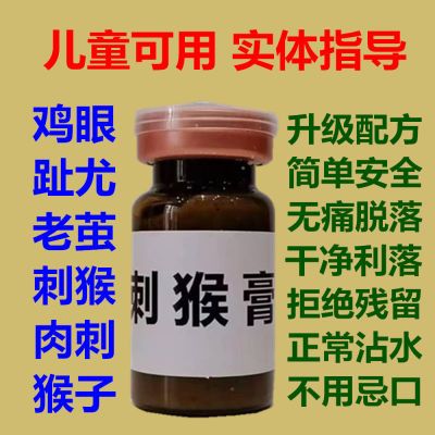 无痛去趾跖疣净肉刺膏水液手脚刺猴子肉粒点痣寻常疣专用药永久【8月11日发完】