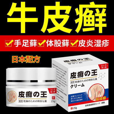 日本进口牛皮癣银屑病专用手足癣花斑癣体股癣头皮癣皮炎止痒药膏