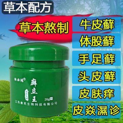 癣立王牛皮癣专用药膏银屑癣湿疹皮炎头皮体癣膏手足癣皮肤痒脸部