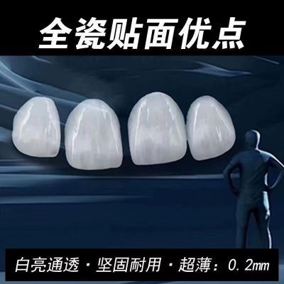 牙齿美白全瓷贴面私人订制玻璃水晶蓝瓷琥珀灵犀瓷牙齿贴面牙缝