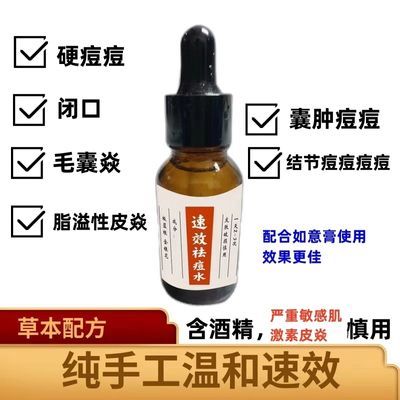 粉刺闭口黑头消炎脂溢性皮炎湿疹青春痘效果杠杠的配合使用如意膏