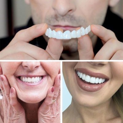 牙套吃饭神器通用老人仿真美白假牙遮盖补牙洞缺牙蛀牙临时补牙套