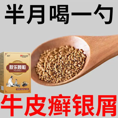 【老偏方】牛皮癣干痒起皮发红大片银屑皮炎手足蜕皮药食同源