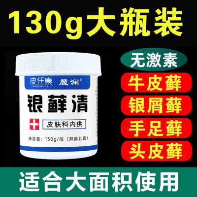 牛皮癣银屑病特效专用抑菌止痒乳膏湿疹130g大瓶装手足头皮体癣用