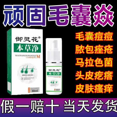 【官方正品】御灵花本草净头皮疙瘩毛囊止痒膏御灵花草本净喷雾