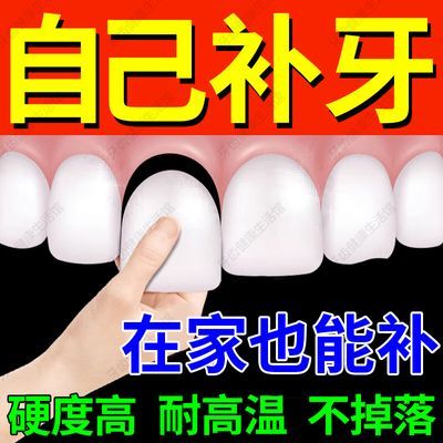 快速补牙临时假牙树脂补牙缝填缝剂永久补牙材料假牙树脂颗粒牙洞