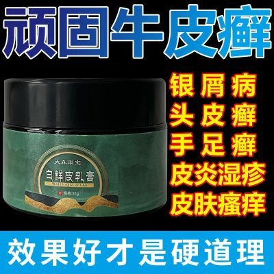 正品【牛皮鲜银屑】天森康宝白鲜皮膏皮肤瘙痒全身止痒牛皮厂家发