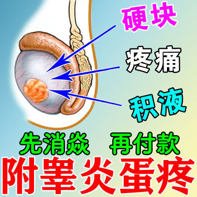 附睾焱蛋疼肿胀囊肿坠疼刺痛结节硬块精索曲张消肿止痛喷剂