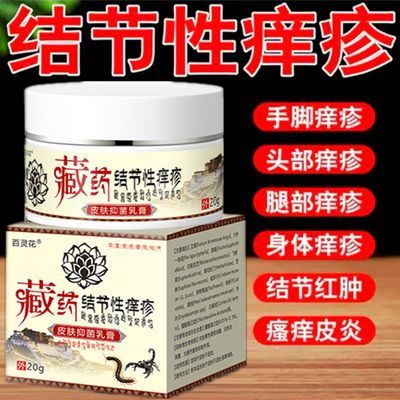 藏药治结节性痒疹顽固硬疙瘩咔苔藓皮肤瘙痒抑菌乳膏止痒外用