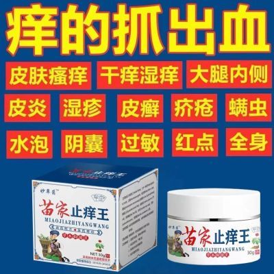 苗家止痒王快速止痒皮肤瘙痒外用全身干痒止痒膏皮肤瘙痒特效抑菌