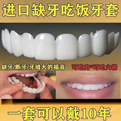 【一套用十年】万能牙套吃饭神器通用补牙缺假牙矫正牙齿无洞牙缝