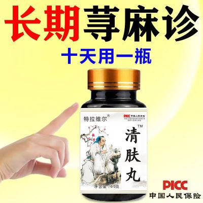 一剂秘方】急慢性荨麻紾止痒风团划痕全身瘙痒起红疙瘩非体乳膏