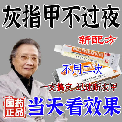 严重灰指甲】真菌感染癣发黑变厚坏甲脱落甲沟炎抑菌硝酸咪康唑