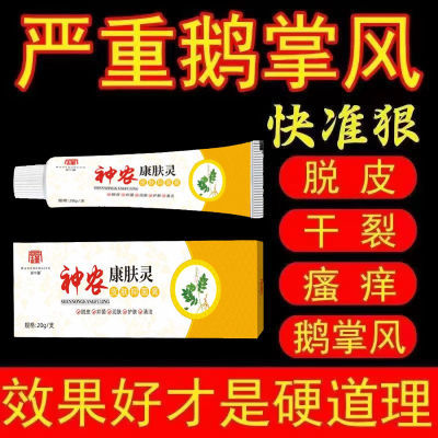 【官方正品】鹅掌风手癣手掌干裂脱皮真菌感染手足顽固癣抑菌乳膏