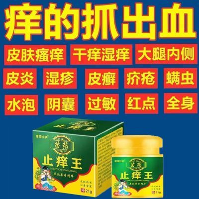 快速止痒皮肤干燥瘙痒外用全身干痒止痒膏皮肤瘙痒抗菌膏正品