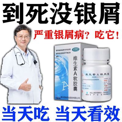 牛皮癣吃的药银屑病内服药皮肤瘙痒起皮体股癣手足癣去癣维生素A