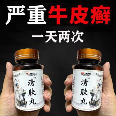 民间土方】牛皮癣头癣手足藓癣股干痒起皮掉屑红斑脓包甘草蒲公英