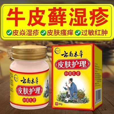 顽固性牛皮癣特效银屑皮炎湿疹手足藓头藓体癣大腿内侧瘙痒止痒膏