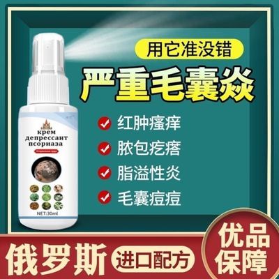 头癣专用脂溢性皮焱毛囊痘痘红疙瘩真菌感染头皮藓止痒去屑喷雾剂