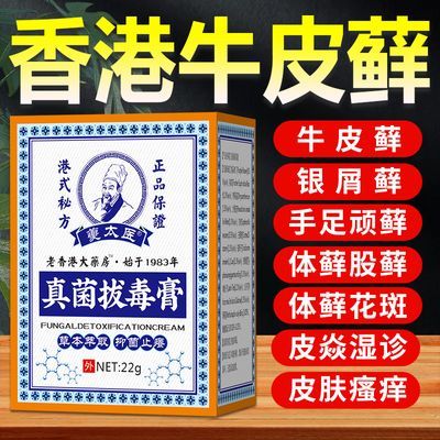 牛皮癣银屑病专用膏顽固性皮炎湿疹手足头皮癣花斑体股藓皮肤瘙痒