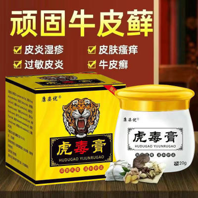 【康姿优虎毒膏】湿疹皮炎牛皮癣头皮癣体癣手足癣皮肤瘙痒止痒膏