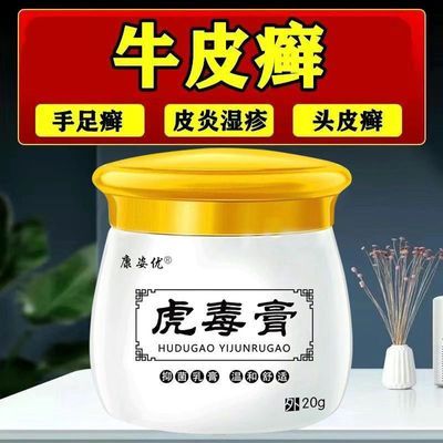 【康姿优虎毒膏】湿疹皮炎牛皮癣头皮癣体癣手足癣皮肤瘙痒止痒膏