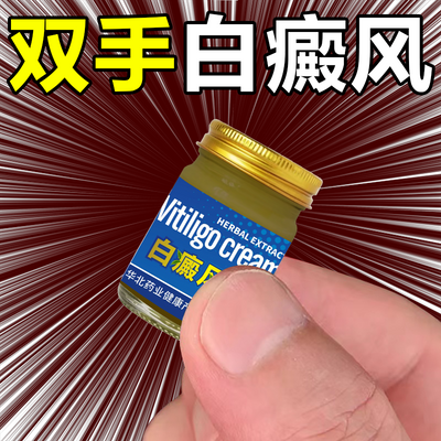 手背白癜风外用黑色素涂抹膏正品原装手上长白斑背部颈部汗斑花斑