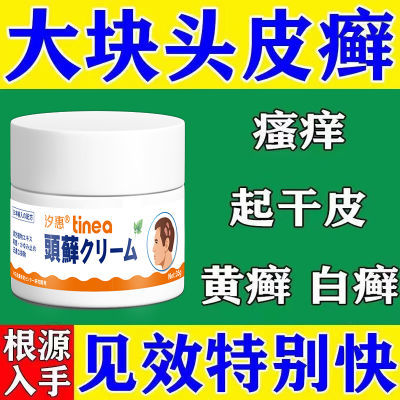 【头癣专用】头皮癣进口膏头部脂溢性皮炎头皮瘙痒毛囊炎银屑真菌