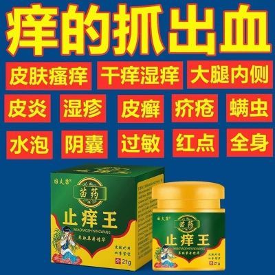 快速止痒皮肤干燥瘙痒外用全身干痒止痒膏皮肤瘙痒抗菌膏正品