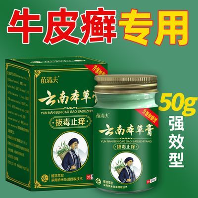 【牛皮癣专用药膏】头癣体癣银屑癣湿疹手足股癣皮肤瘙痒止痒王