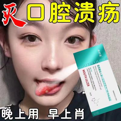 治口腔溃疡 烂嘴药反复烂嘴巴义齿手术修复创面愈合 口腔溃疡凝