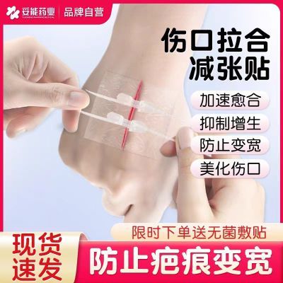 医用减张贴皮肤减张器儿童疤痕伤口拉合免缝针缝合器拉链式创口贴