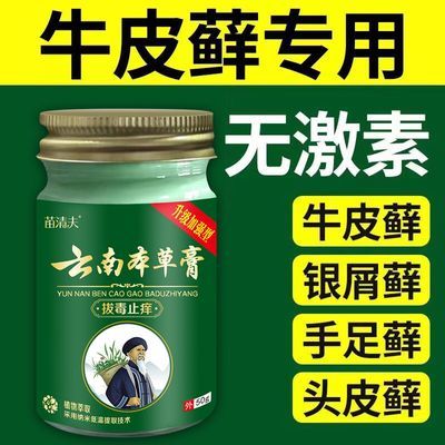 【牛皮癣膏】银屑癣牛皮癣专用止痒膏湿疹头癣体癣手足藓皮肤瘙痒